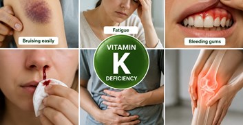 علائم کمبود ویتامین K چیست ؟
